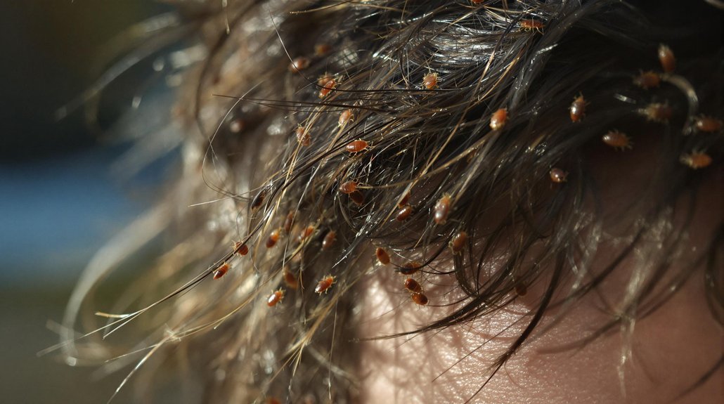 Can Bed Bugs Travel in Your Hair? Here’s the Truth 2026